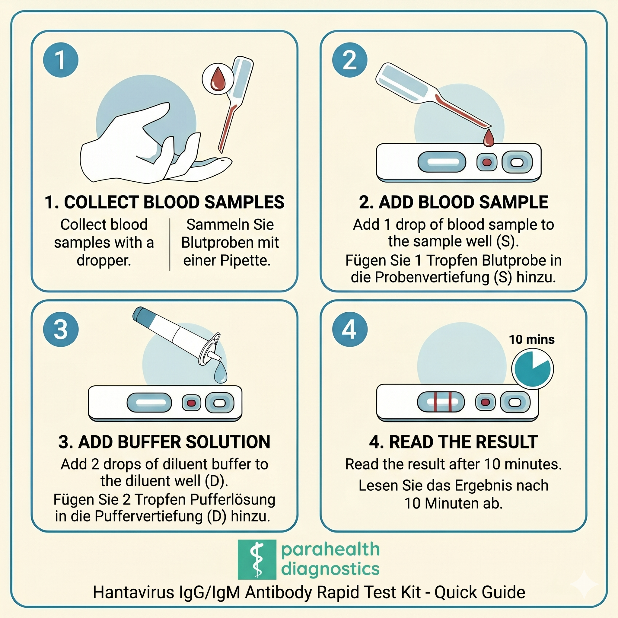 Test Hantavirus — Kit de test rapide anticorps IgG/IgM